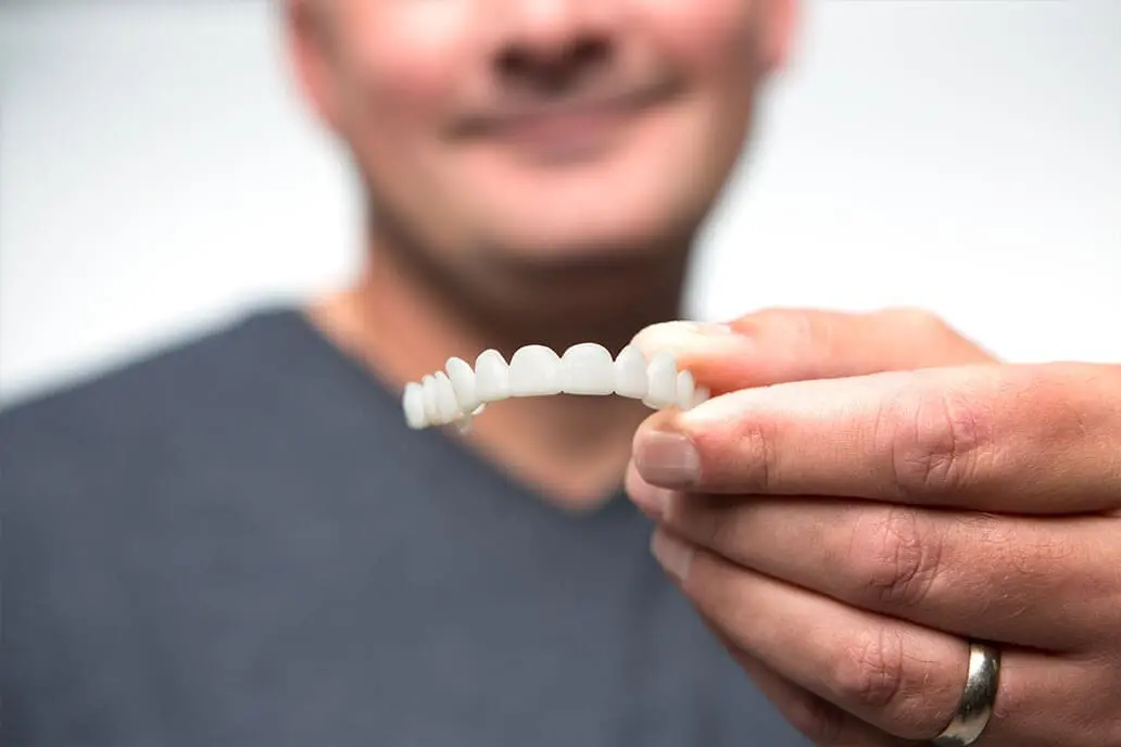 Person holding some clip-on veneers for teeth to give you a perfect, white smile.