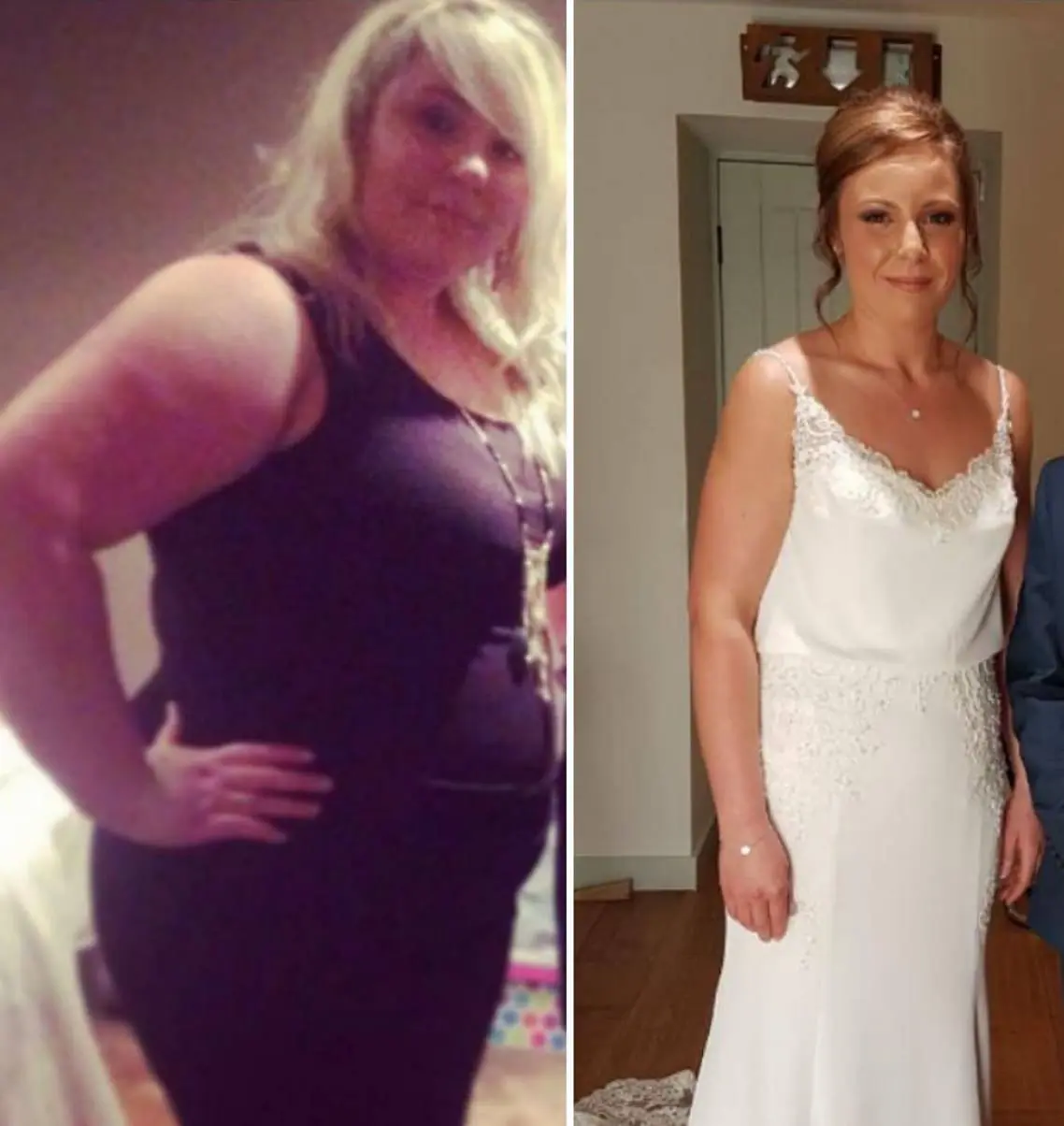 Side-by-side comparison of the same woman before and after significant weight loss, wearing a black dress on the left and a white dress on the right.